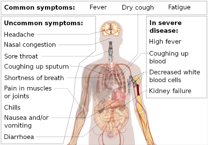 800px-Symptoms_of_coronavirus_disease_2019_2.0.svg