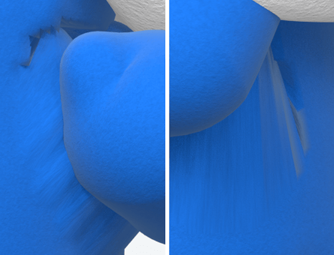 3_shoulder_crumple
