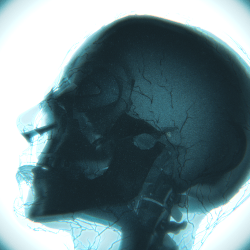 xray