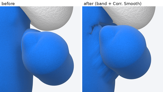 1_shoulder_orb