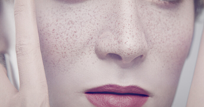 scars-freckles-2