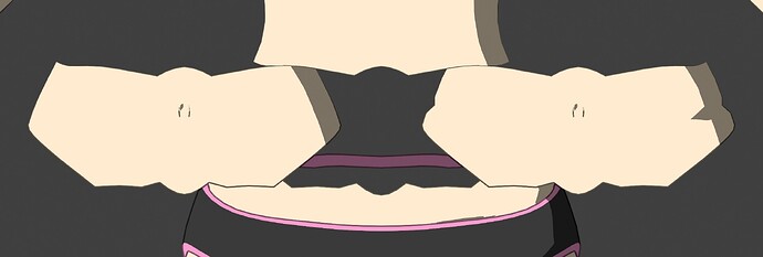 multiple-stomach-meshes