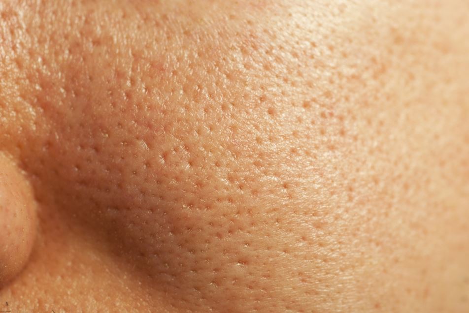 Face pores skin thingy.